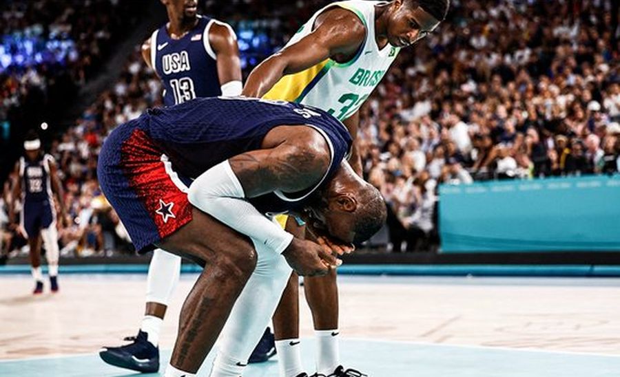 Леброну Джеймсу після матчу з Бразилією довелось перенести хірургічне втручання на обличчі 2 - basket.com.ua Леброну Джеймсу після матчу з Бразилією довелось перенести хірургічне втручання на обличчі 1 - basket.com.ua