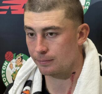 "Дуже контактні тренування". Гравець "Бостона" отримав криваву рану на зборах команди 27